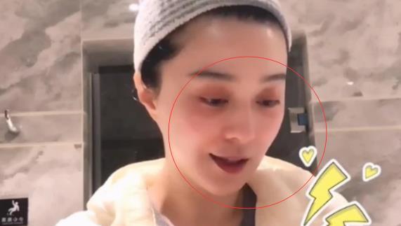 嘴唇发紫的明星,揭秘嘴唇发紫的明星风采